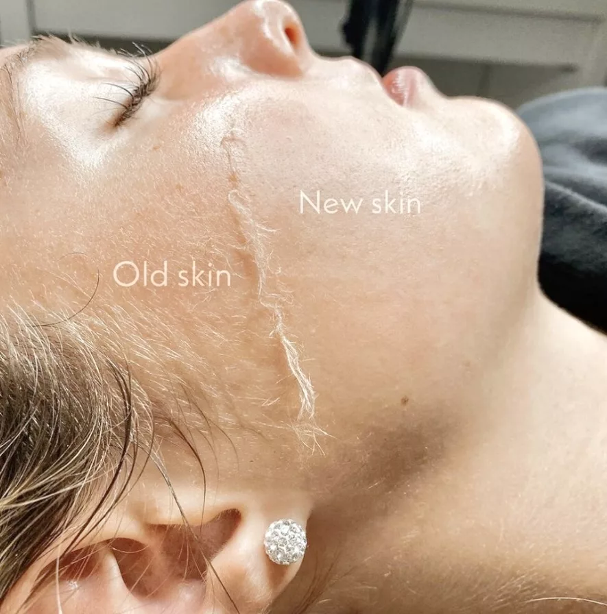 hydrofacial facial jacksonville Florida